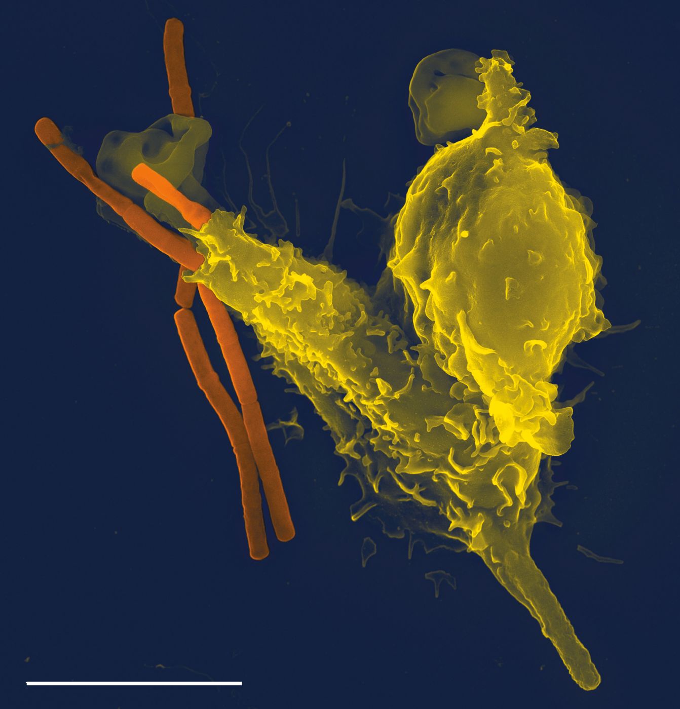 The Immune System